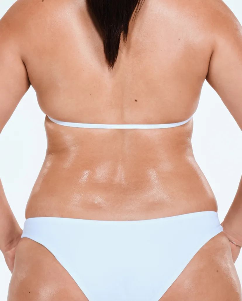 Zoomed-in image of model's flanks