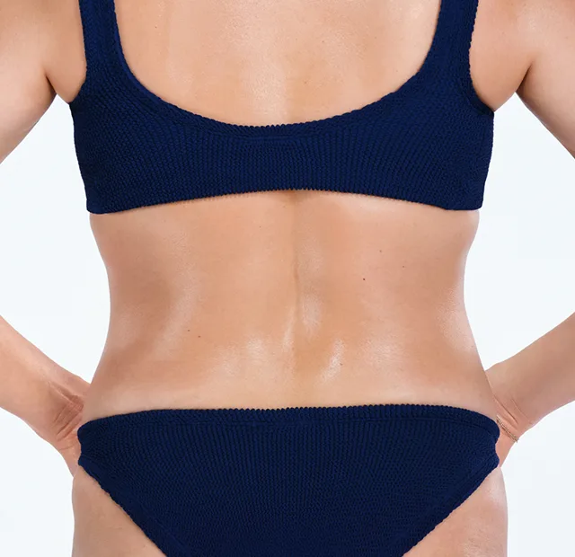 Zoomed-in image of model's back