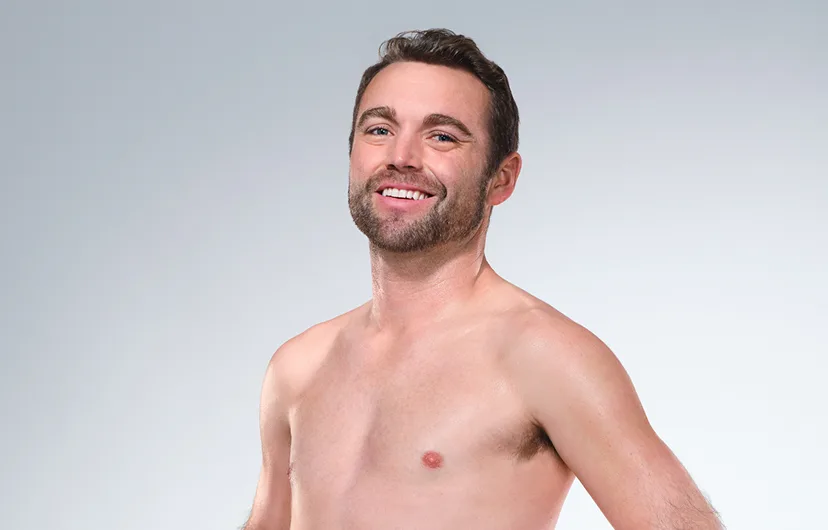 Caucasian male model's CoolSculpting results