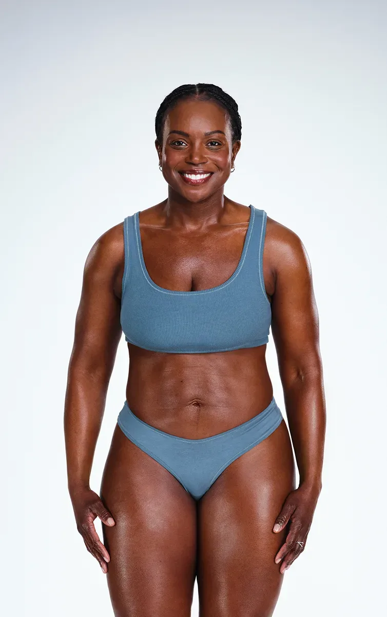 African American female's CoolSculpting results