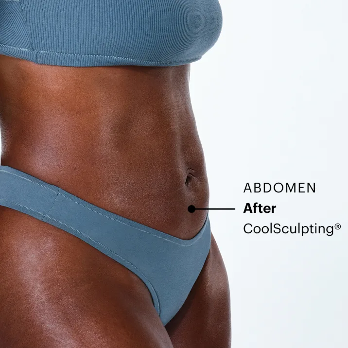 Zoomed-in image of CoolSculpting model's abdomen after the treatment 