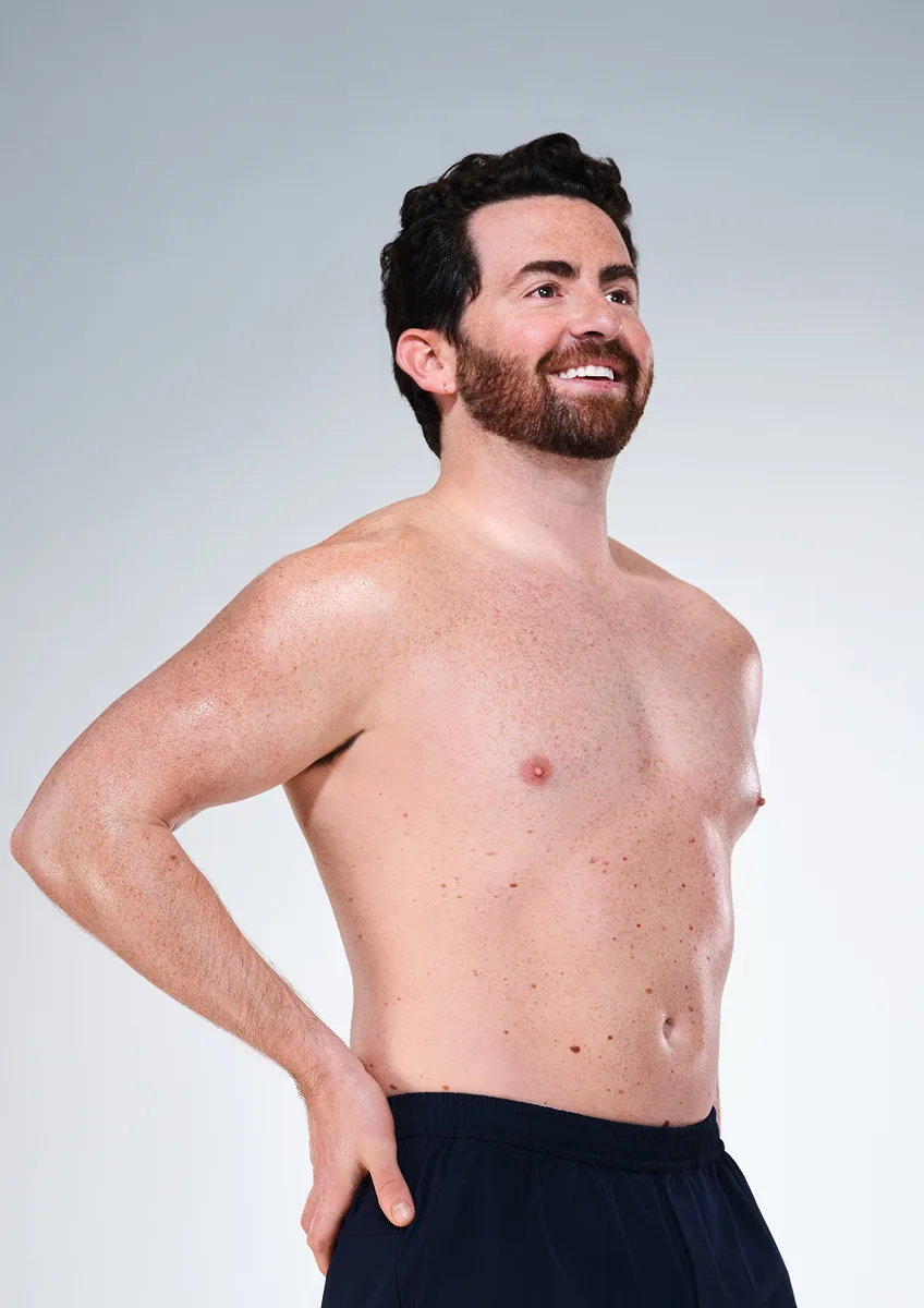 CoolSculpting male model before & after CoolSculpting
