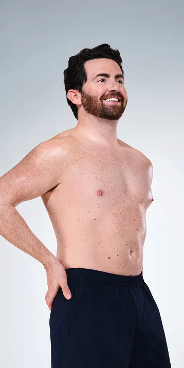 CoolSculpting male model before & after CoolSculpting