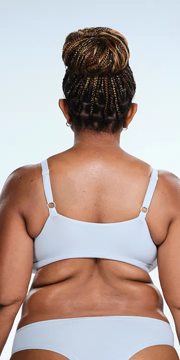 Before and after images of CoolSculpting female model's love handles
