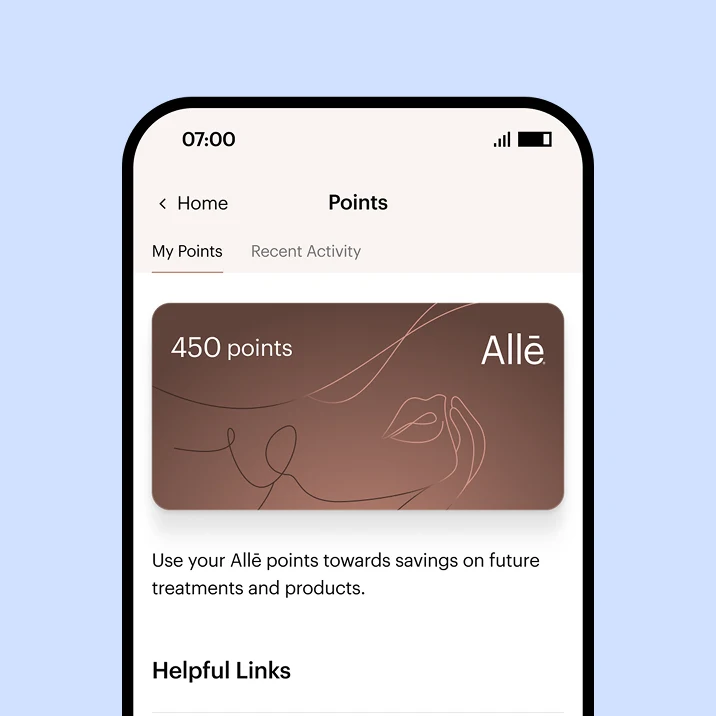 Screenshot of a phone showing how one can earn points with Alle