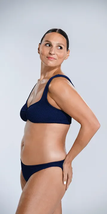 CoolSculpting female model before & after CoolSculpting