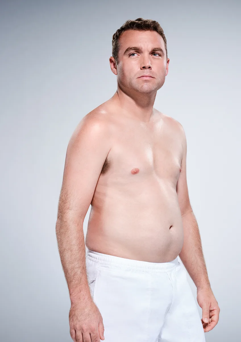 CoolSculpting male model before & after CoolSculpting