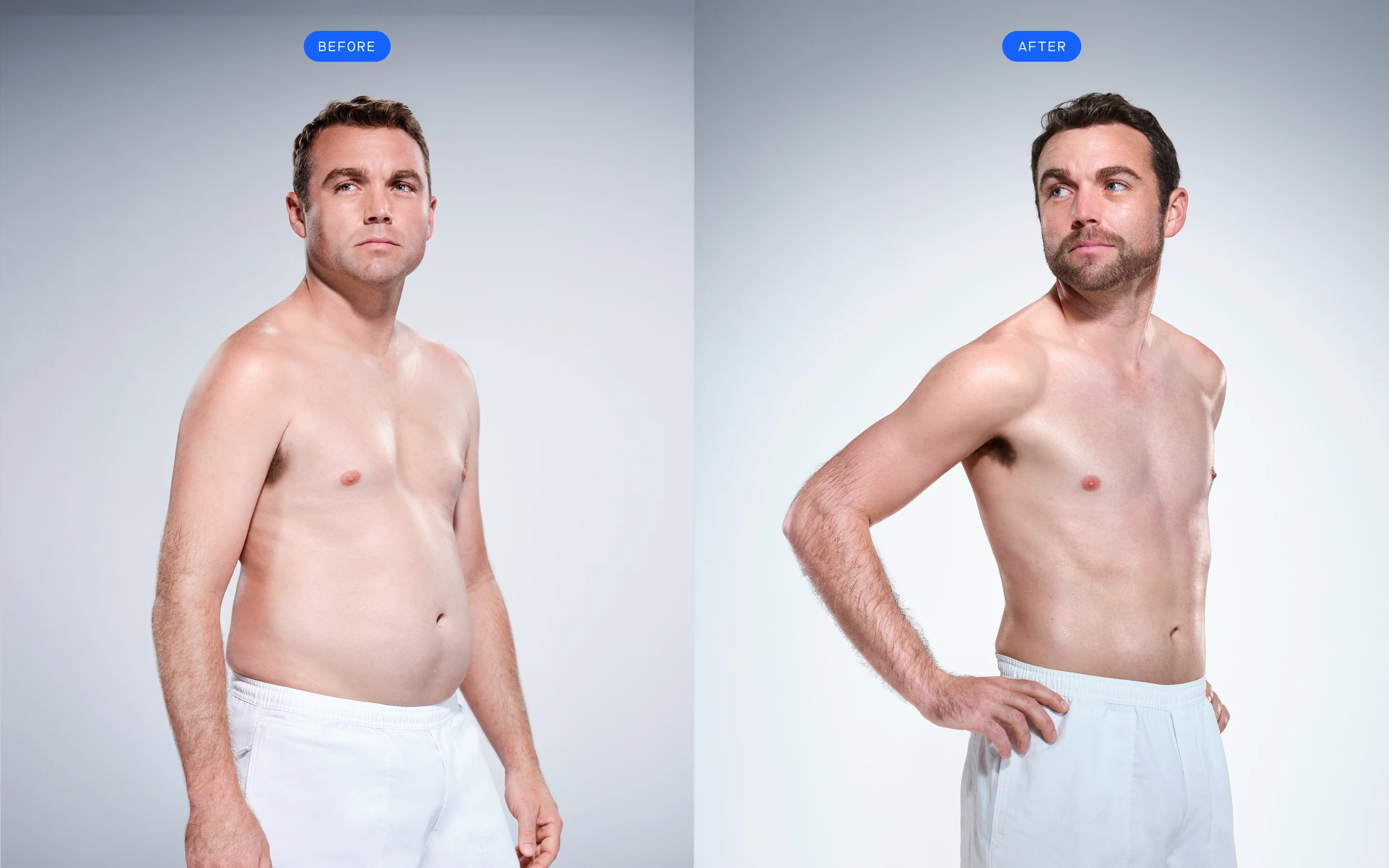 CoolSculpting male model before & after CoolSculpting
