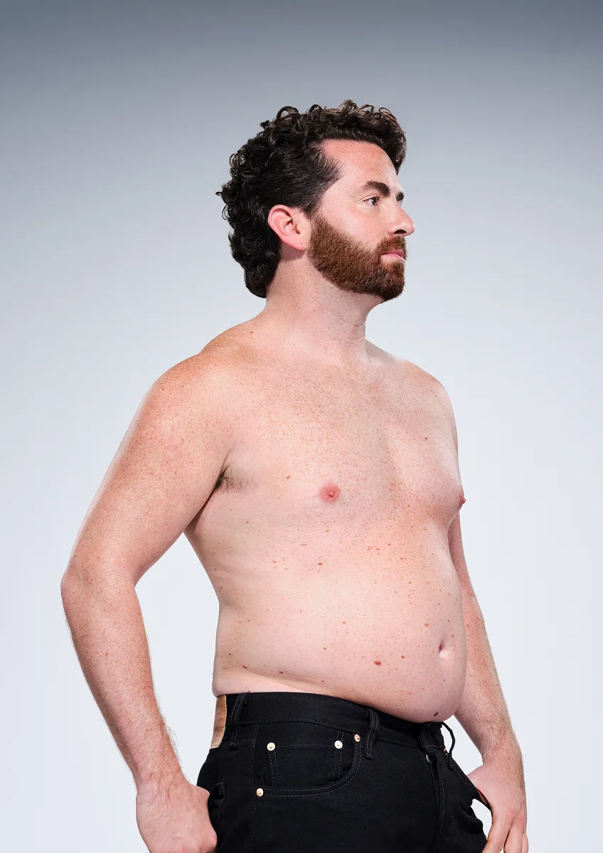 CoolSculpting male model before & after CoolSculpting