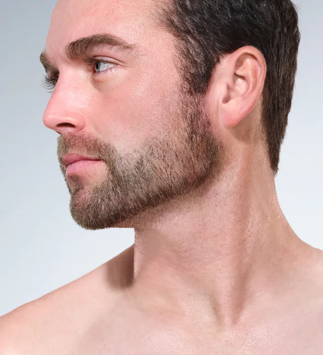Zoomed-in image of model's chin