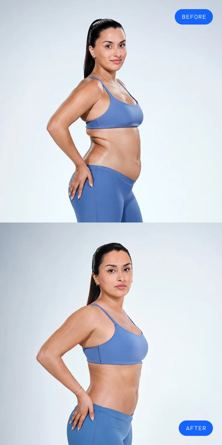 CoolSculpting before & after of model's abdomen