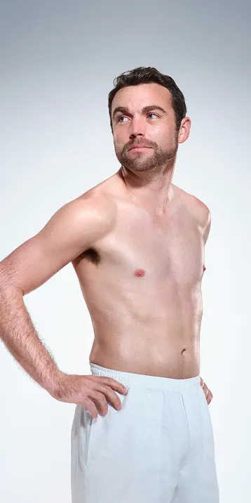 CoolSculpting male model before & after CoolSculpting
