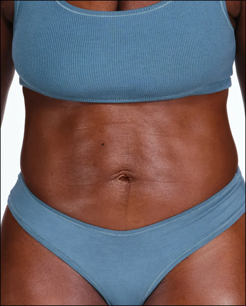 Zoomed-in image of model's flanks