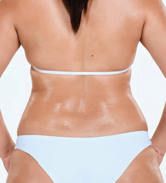 Zoomed-in image of model's flanks