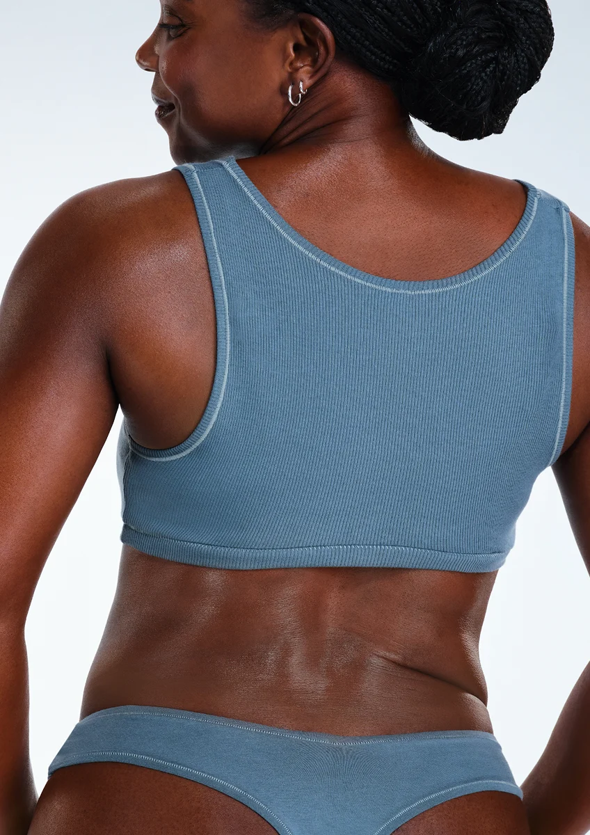Before and after images of CoolSculpting female model's back fat/bra fat