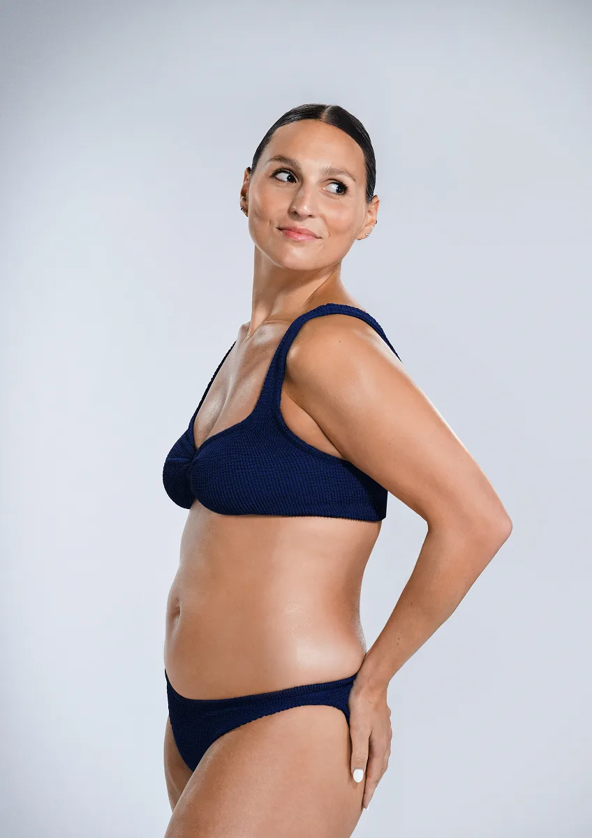 CoolSculpting female model before & after CoolSculpting