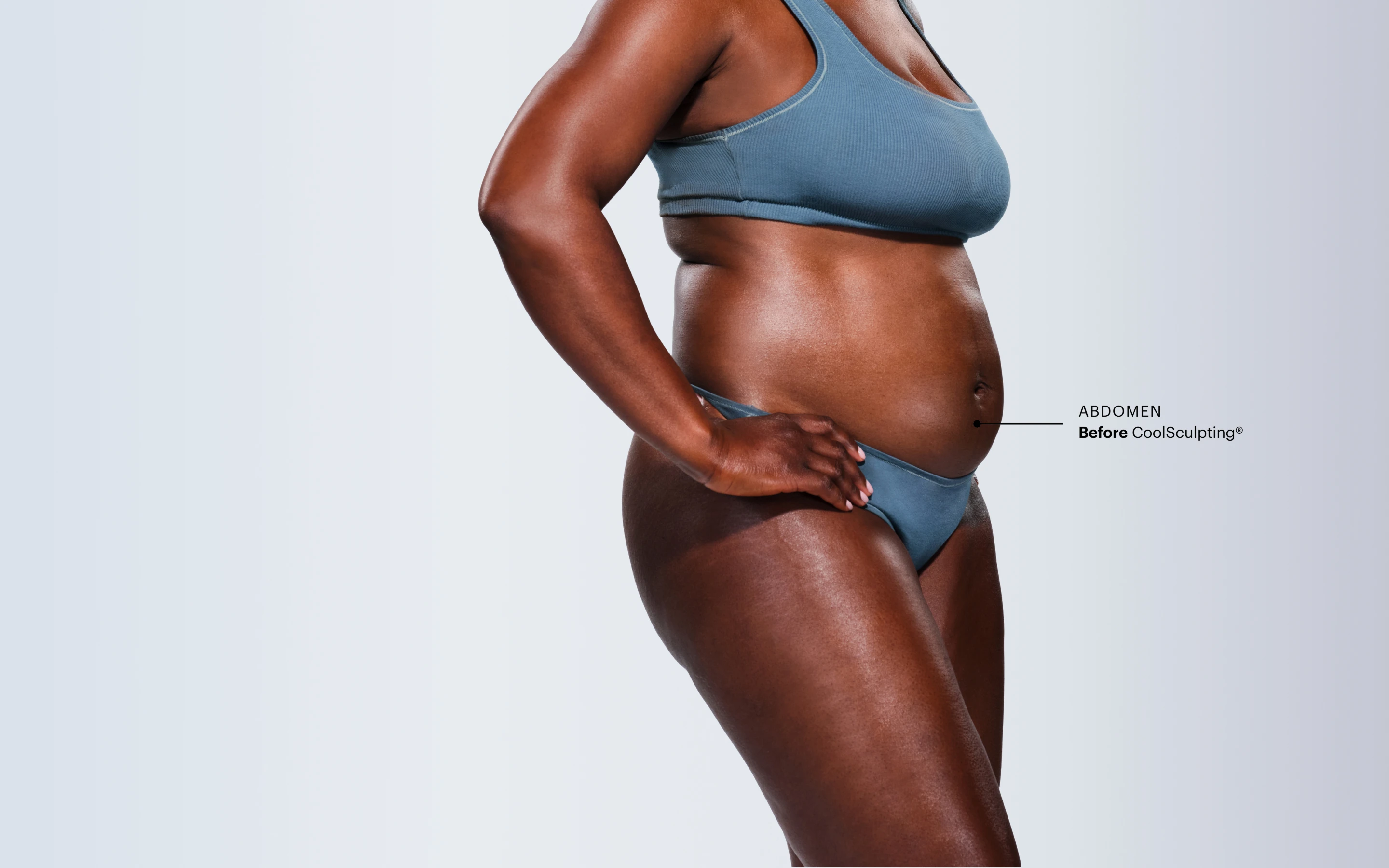 Zoomed-in image of CoolSculpting model's abdomen before the treatment