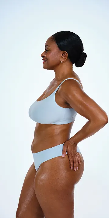 CoolSculpting female model before & after CoolSculpting