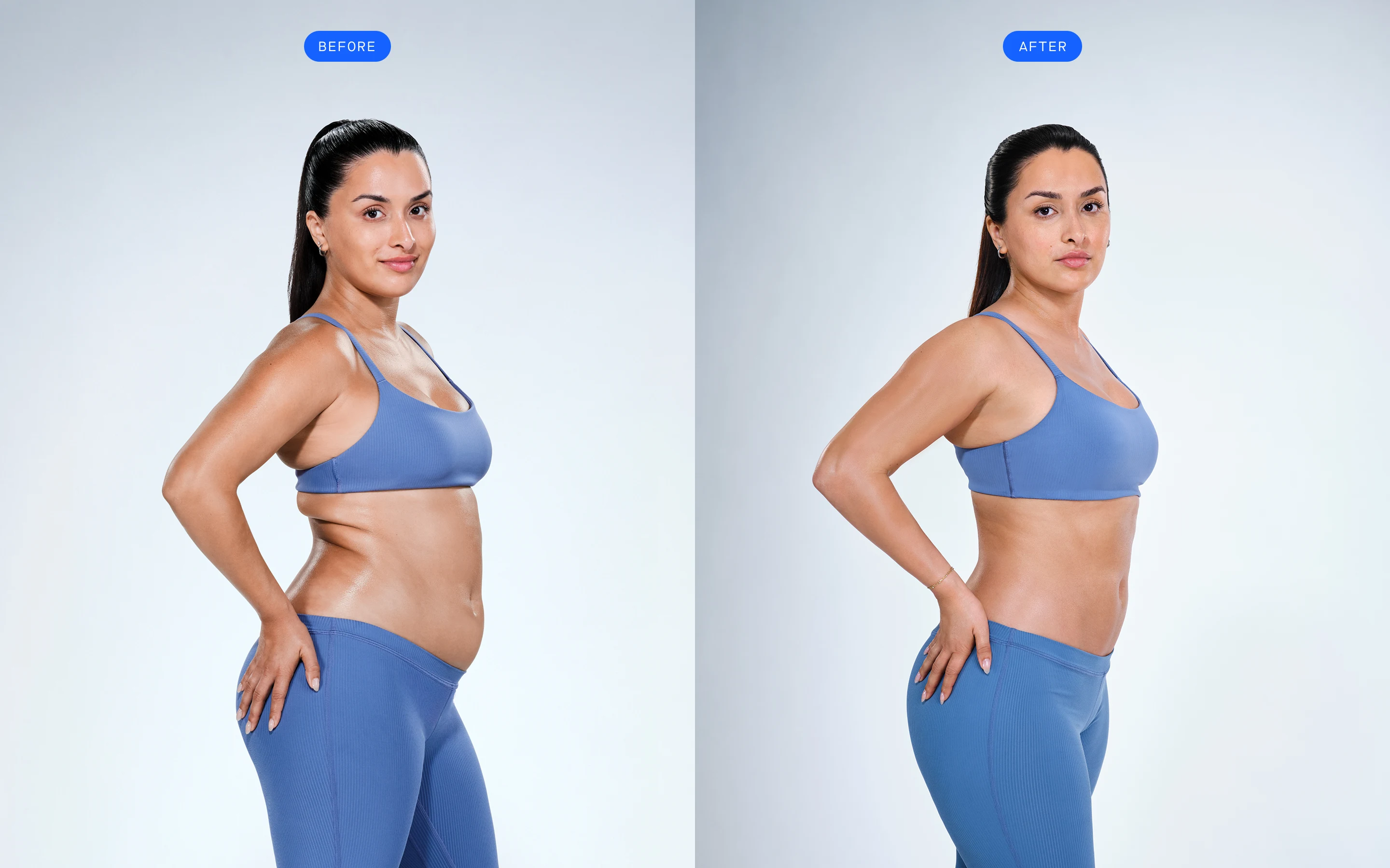 CoolSculpting before & after of model's abdomen