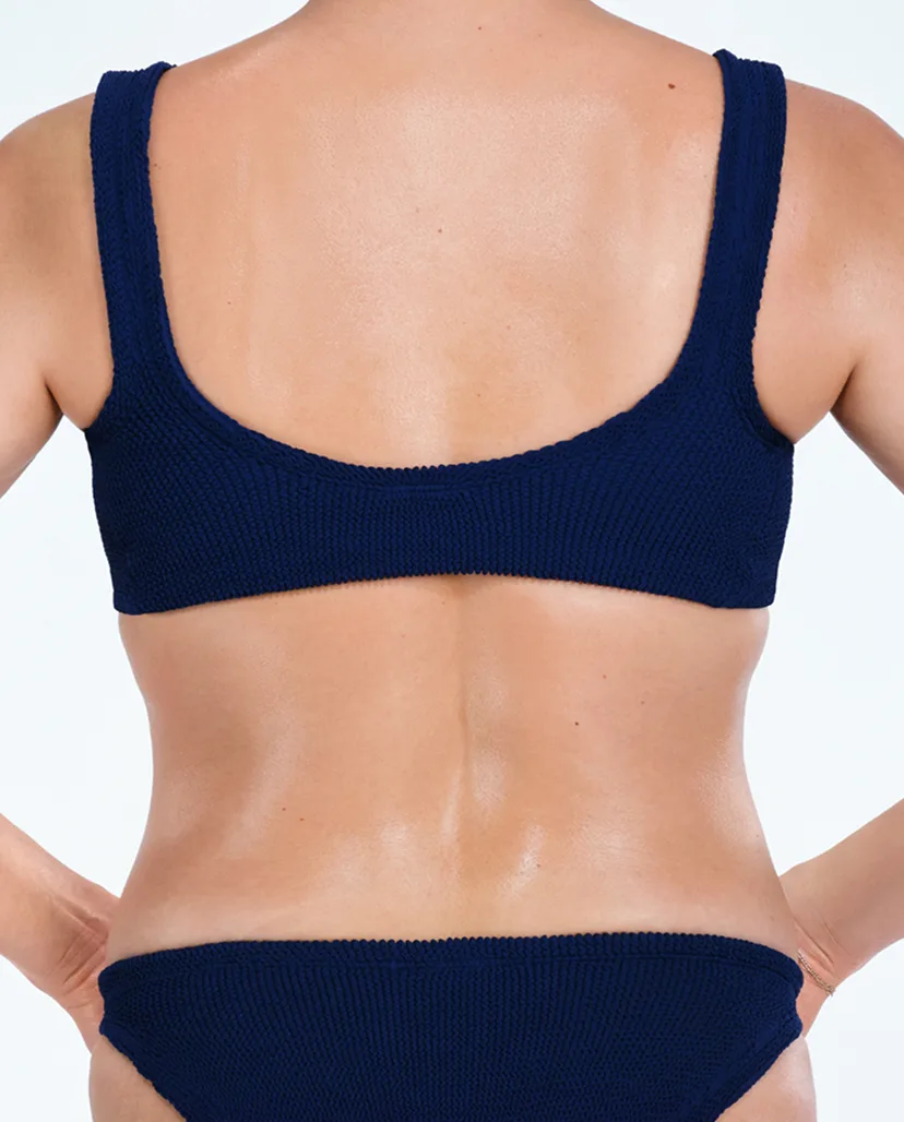 Zoomed-in image of model's back