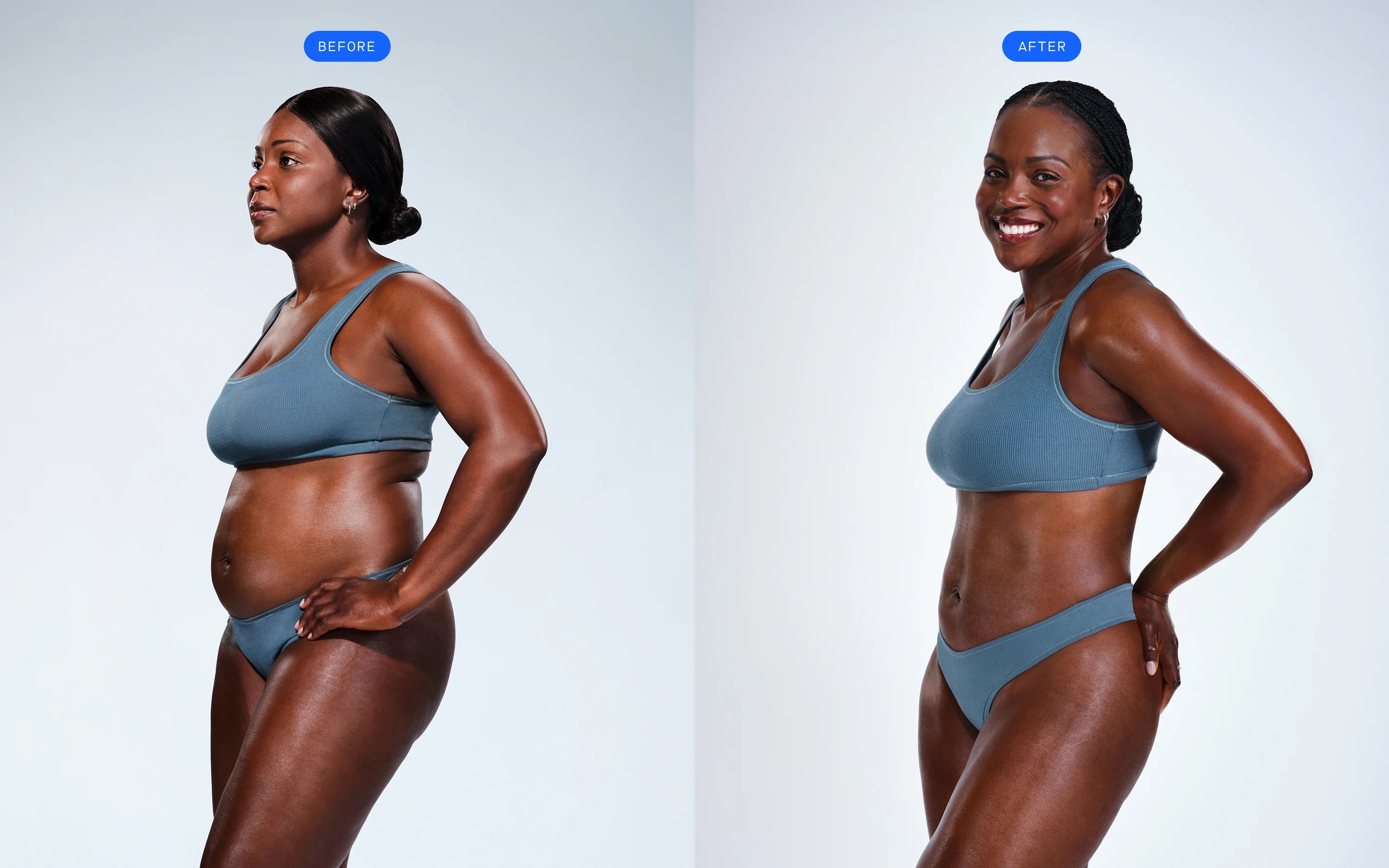 African American female showing her CoolSculpting before & after
