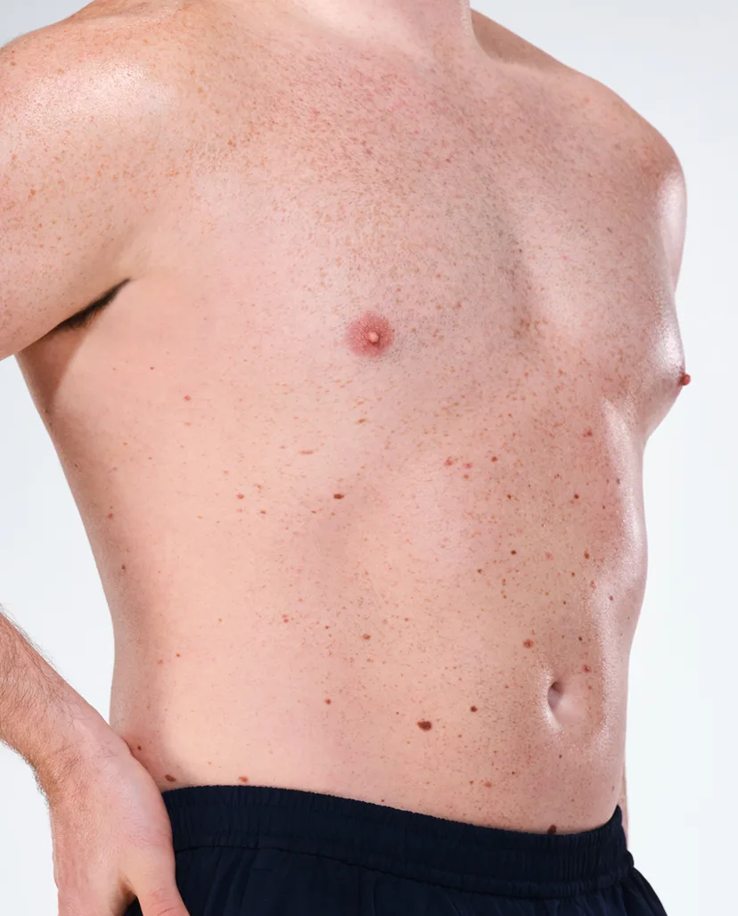 Zoomed-in image of model's flanks