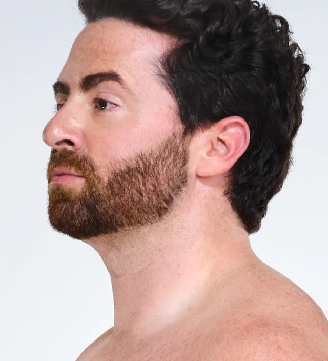 Zoomed-in image of model's chin