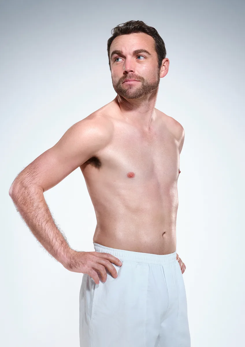 CoolSculpting male model before & after CoolSculpting