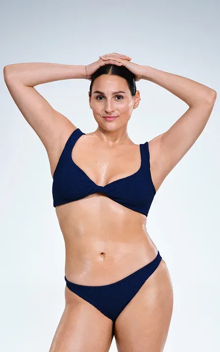 Caucasian female's CoolSculpting results