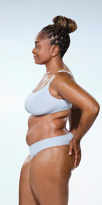 CoolSculpting female model before & after CoolSculpting
