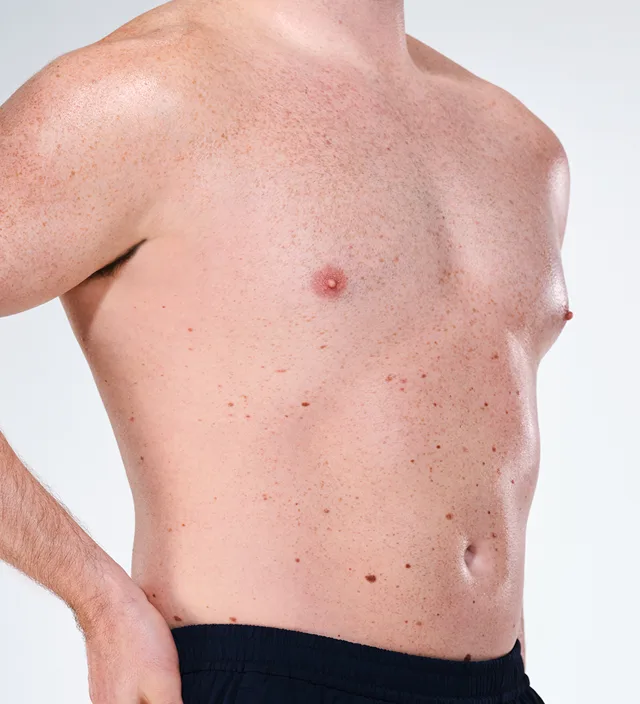 Zoomed-in image of model's flanks