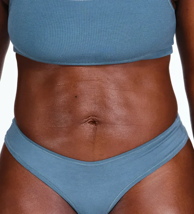 Zoomed-in image of model's flanks