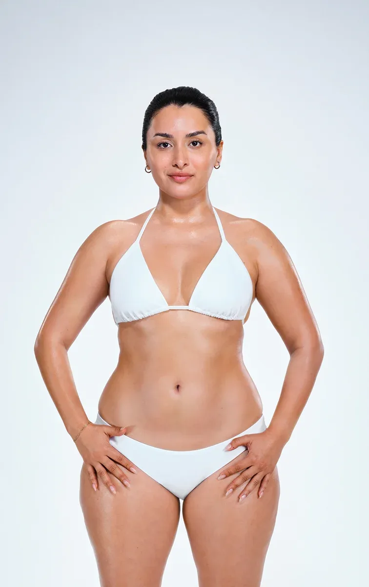 Latina female's CoolSculpting results