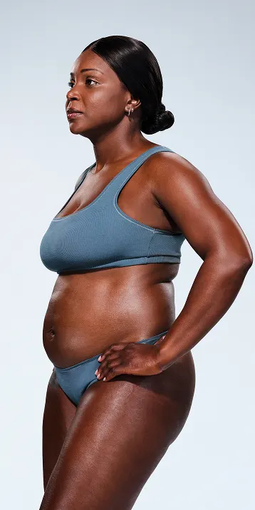 CoolSculpting female model before & after CoolSculpting