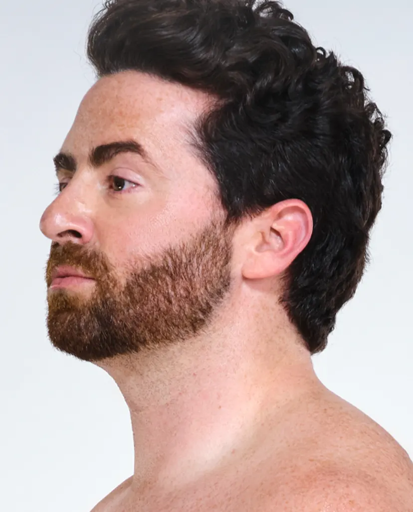Zoomed-in image of model's chin