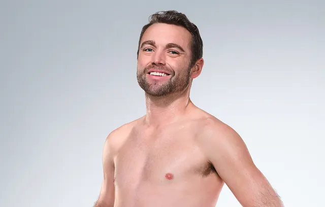 Caucasian male model's CoolSculpting results