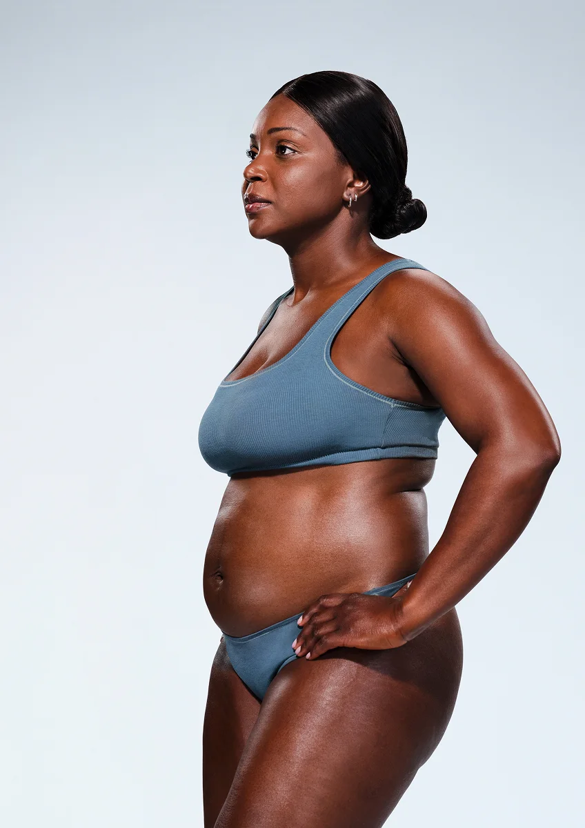 CoolSculpting female model before & after CoolSculpting