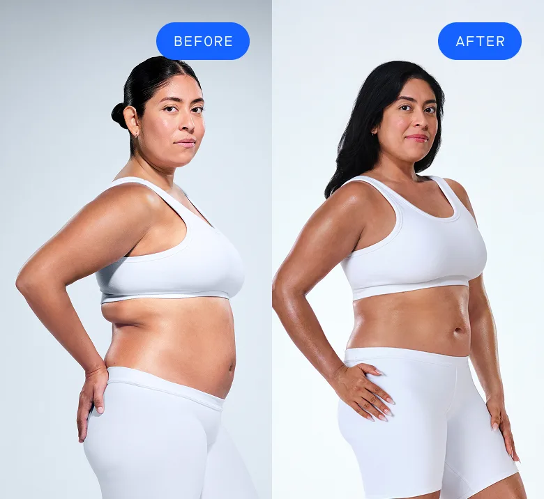 CoolSculpting female model before & after CoolSculpting