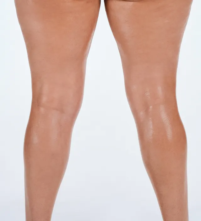 Zoomed-in image of model's thighs