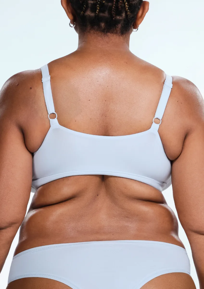 Before and after images of CoolSculpting female model's love handles