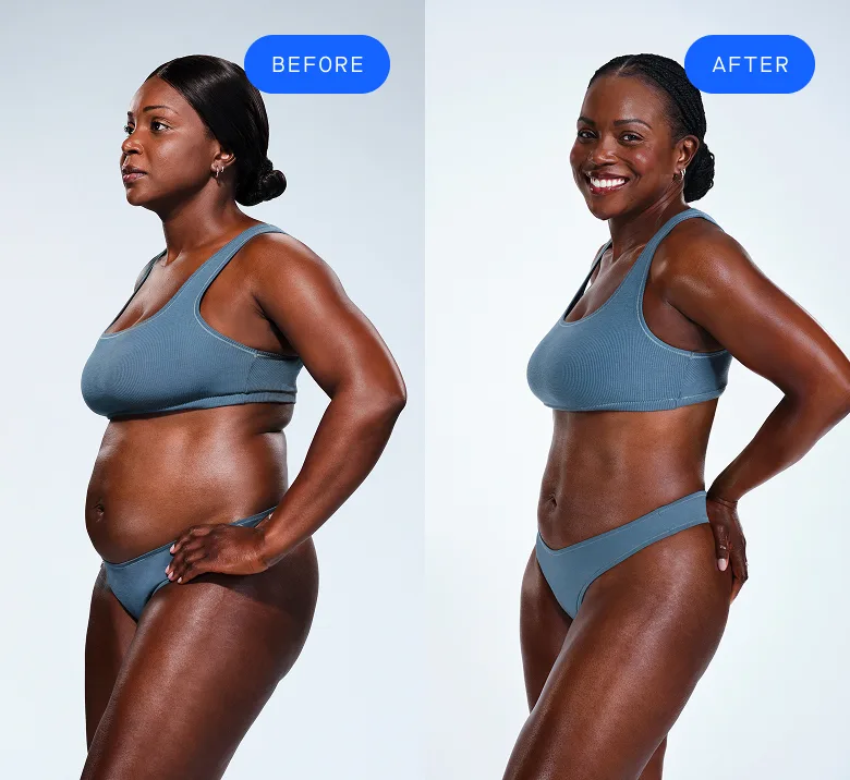 African American female showing her CoolSculpting before & after