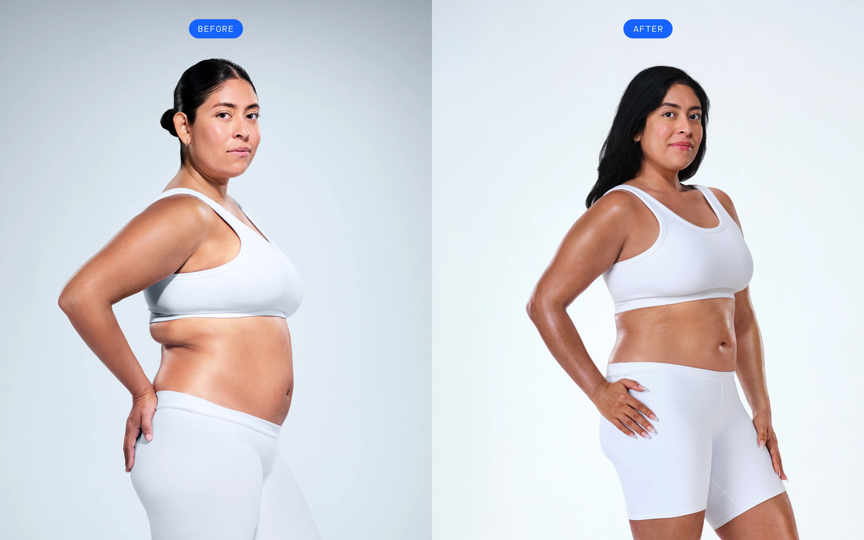 CoolSculpting female model before & after CoolSculpting