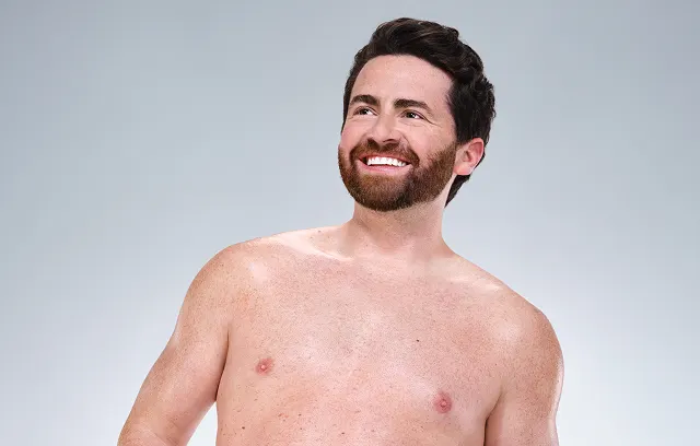 Caucasian male model's CoolSculpting results