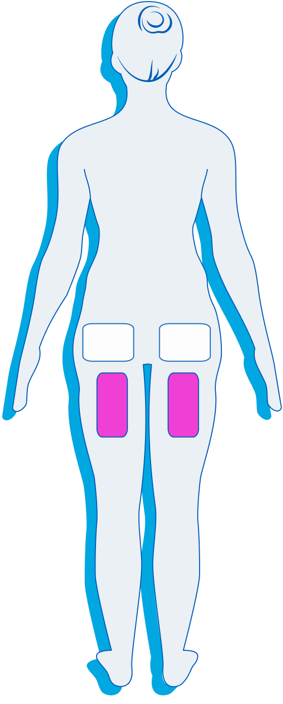 Female Back