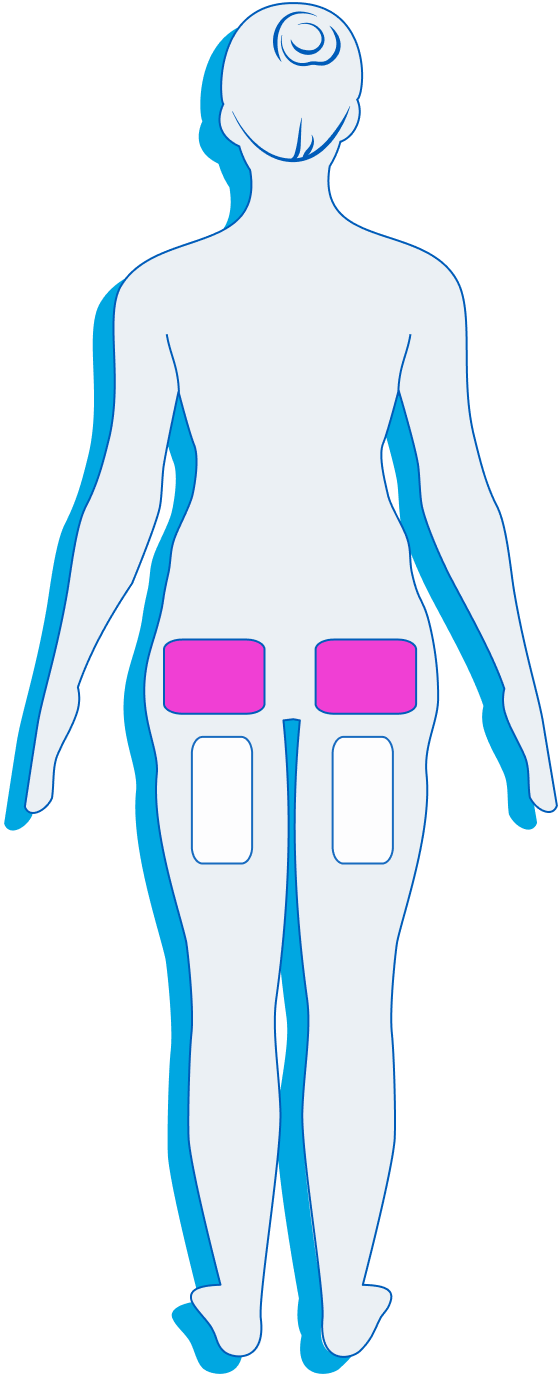 Female Back